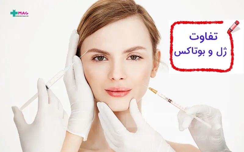 تفاوت ژل و بوتاکس