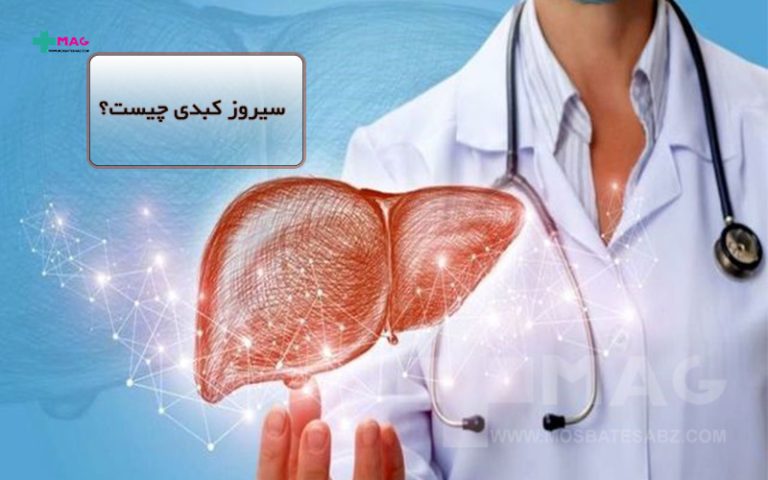 سیروز کبدی
