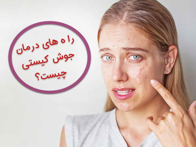 جوش کیستی چیست