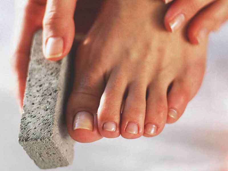 راه های از بین بردن پوست های مرده از روی پا