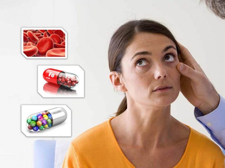 همه چیز در باره مکمل آهن
