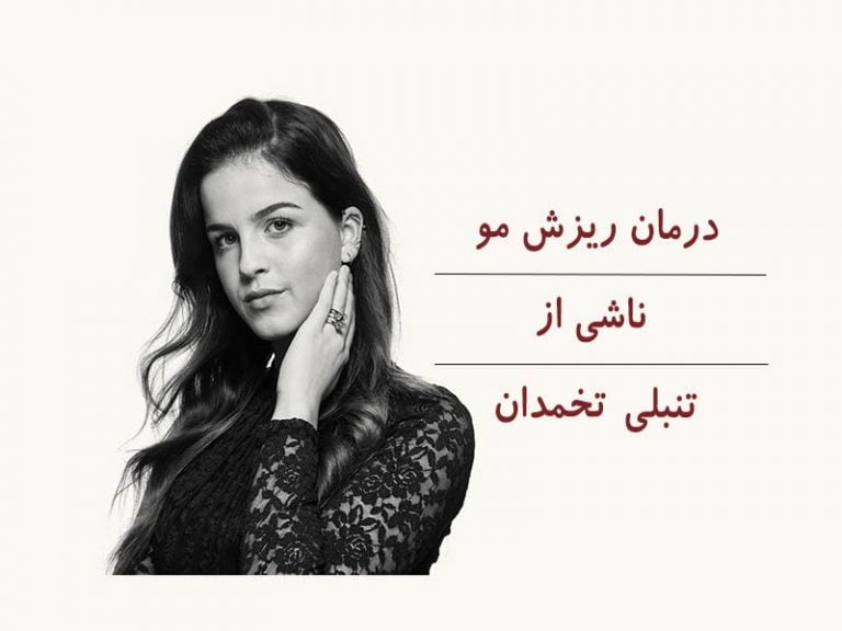 درمان ریزش مو ناشی از تنبلی تخمدان را می دانید؟