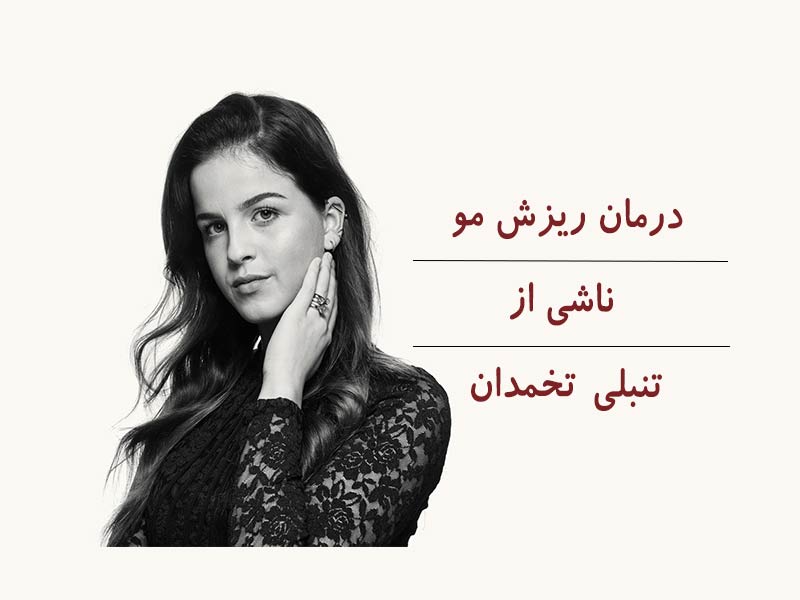 درمان ریزش مو ناشی از تنبلی تخمدان را می دانید؟