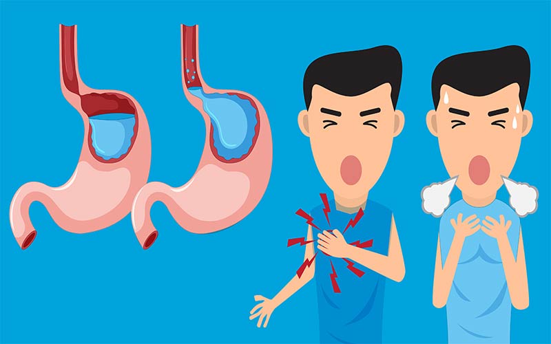 رابطه رفلاکس معده و تنگی نفس چیست؟