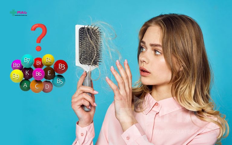 کمبود کدام ویتامین ها باعث ریزش مو میشود؟- کمبود ویتامین و ریزش مو