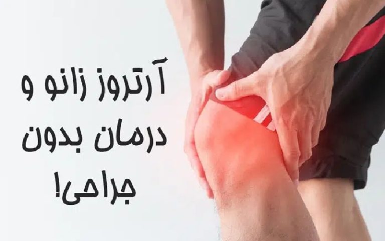 آرتروز زانو و درمان های بدون جراحی