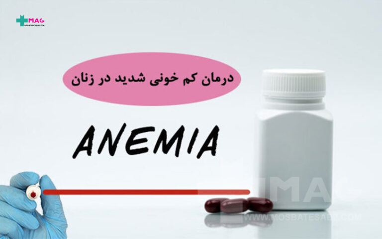 درمان کم خونی شدید در خانم ها