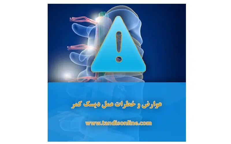 خطر عمل دیسک کمر