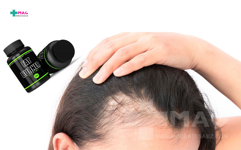 قرص چربی سوز و ریزش مو