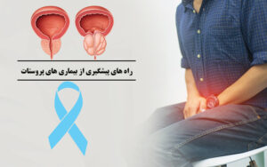 راه های پیشگیری از پروستات