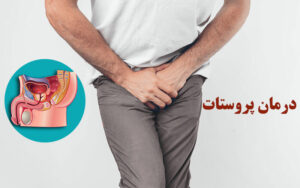 درمان پروستات