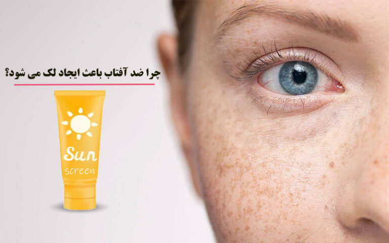 تاثیر ضد آفتاب بر ایجاد لک