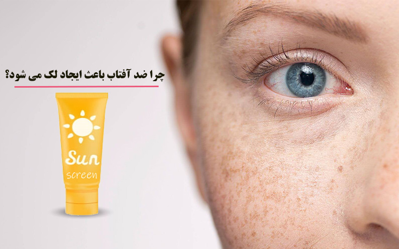 تاثیر ضد آفتاب بر ایجاد لک