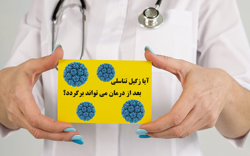 برگشت زگیل تناسلی بعد از درمان