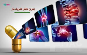 بهترین مکمل غضروف ساز