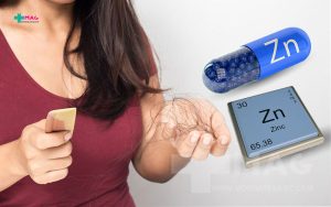 نحوه مصرف قرص زینک برای ریزش مو