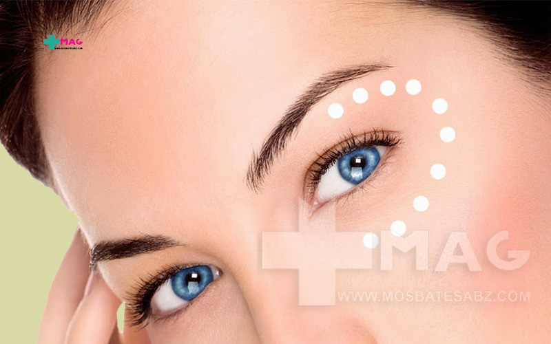 تاثیر کرم دور چشم چقدر است
