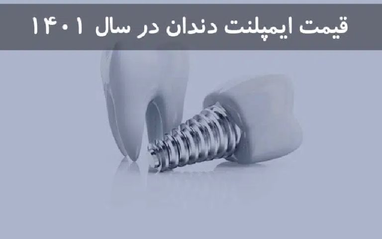 ایمپلنت دندان در سال 1401