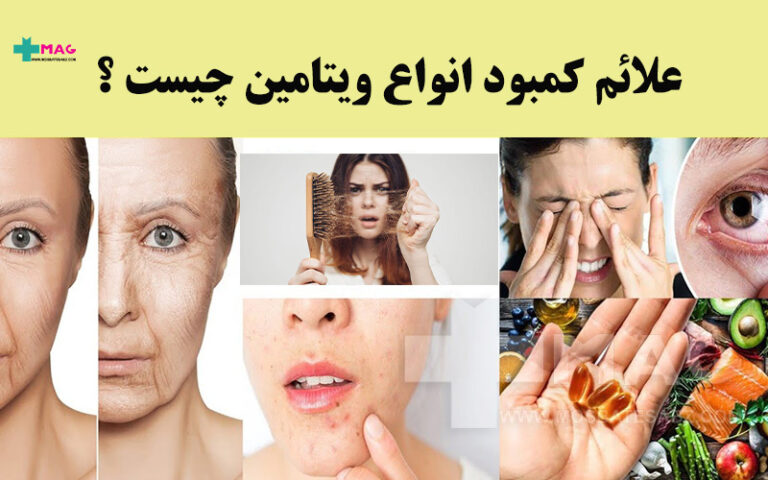 علائم کمبود انواع ویتامین