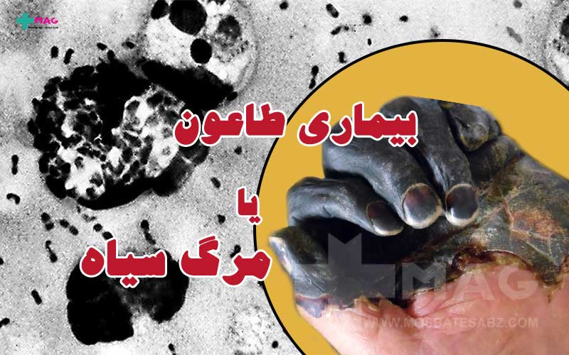 بیماری طاعون چیست و چگونه درمان می شود