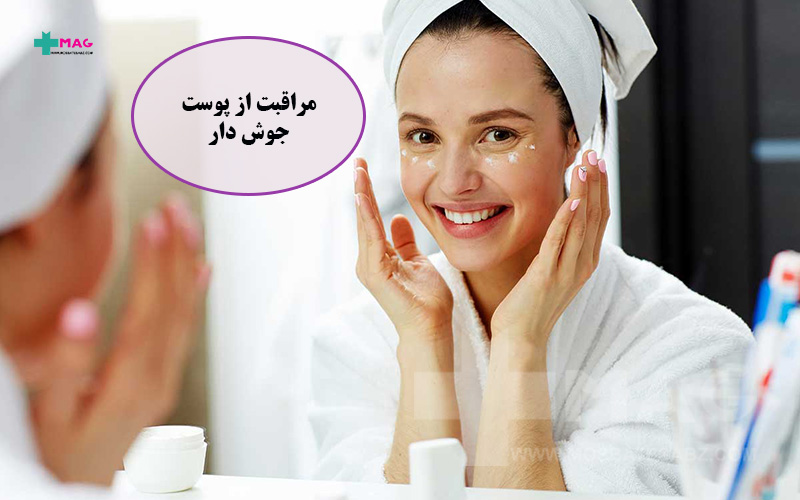 روتین روزانه مراقبت از پوست جوش دار