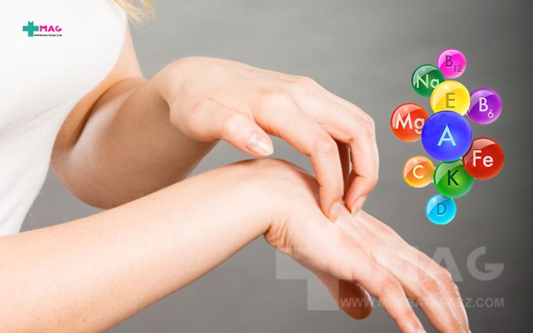 حساسیت به مولتی ویتامین