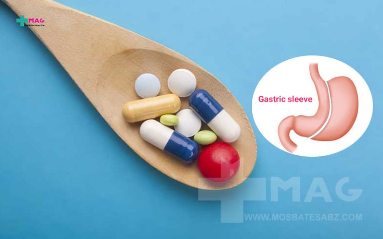 مولتی ویتامین بعد عمل اسلیو