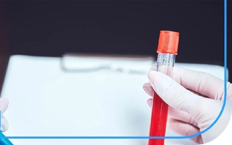 چطور آزمایش خون در منزل انجام می شود