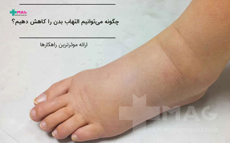 کاهش التهاب بدن
