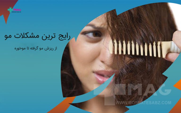 مشکلات مو