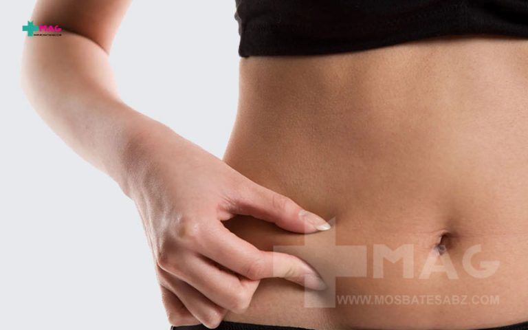 چاقی زیر شکم در افراد لاغر