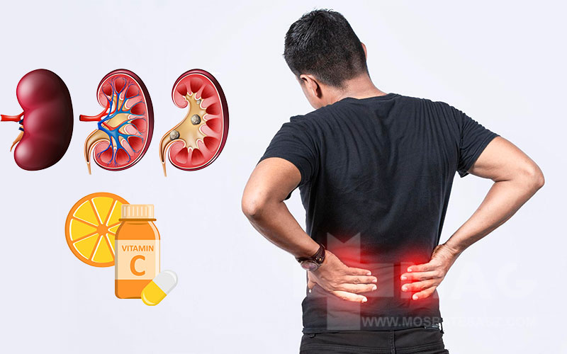 مصرف این ویتامین شما را دچار سنگ کلیه می کند