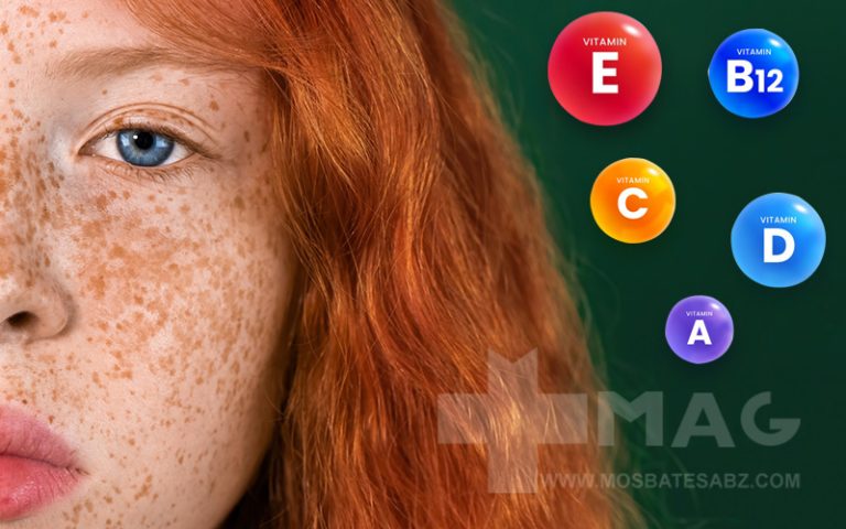 کمبود چه ویتامینی باعث تیرگی پوست میشود