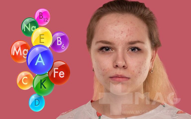 کمبود کدام ویتامین باعث مشکلات پوستی می شود
