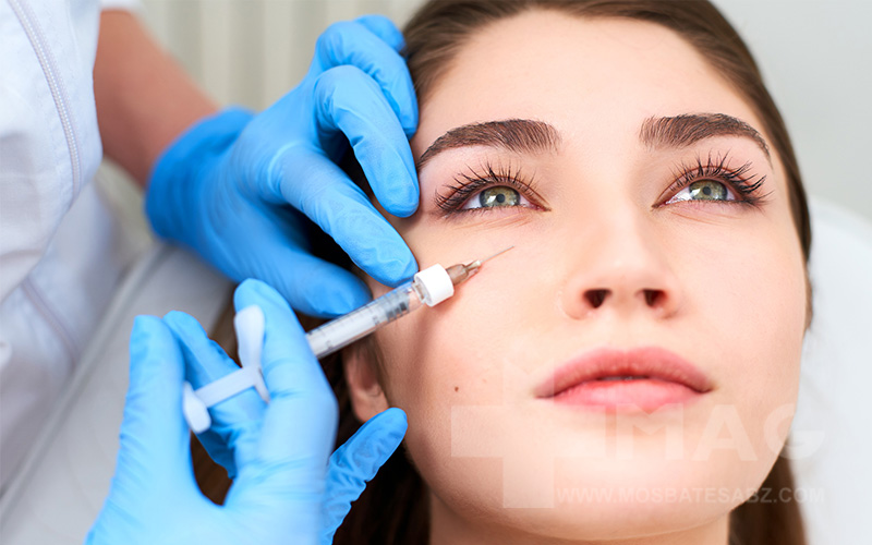 کربوکسی تراپی زیر چشم