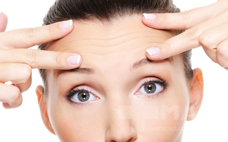 سابسیژن خط اخم چیست