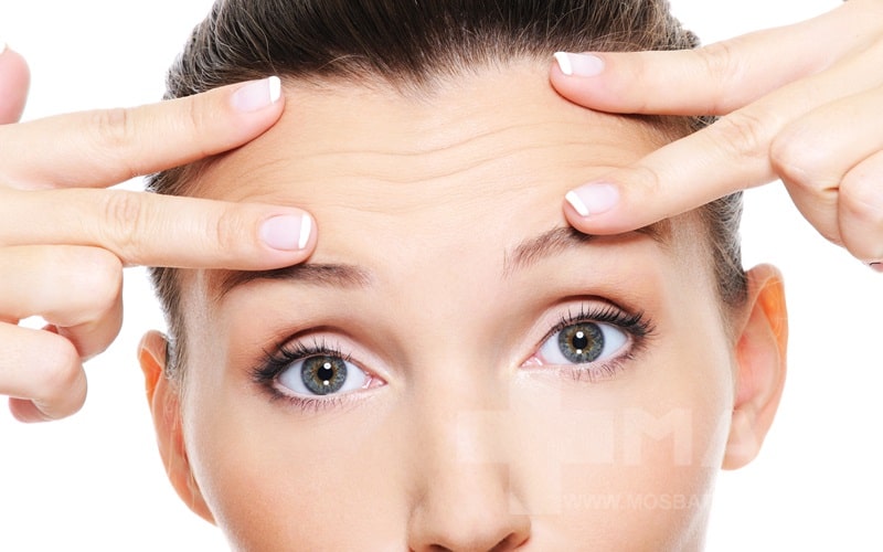 سابسیژن خط اخم چیست