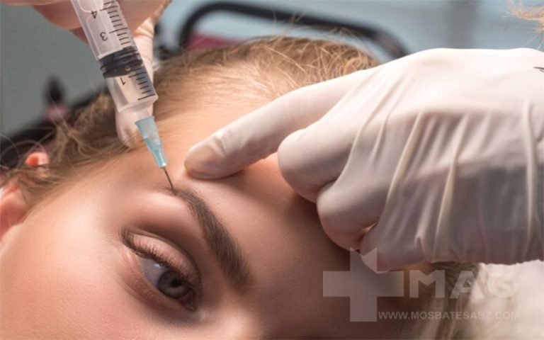 کربوکسی تراپی ابرو