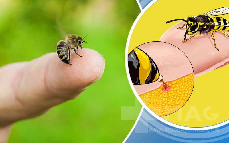 همه چیز درباره نیش زنبور عسل