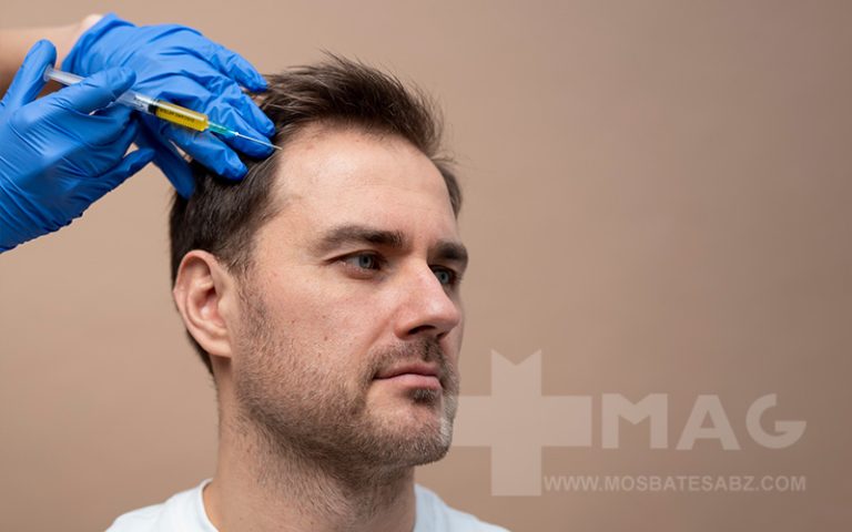 عوارض مزوتراپی مو