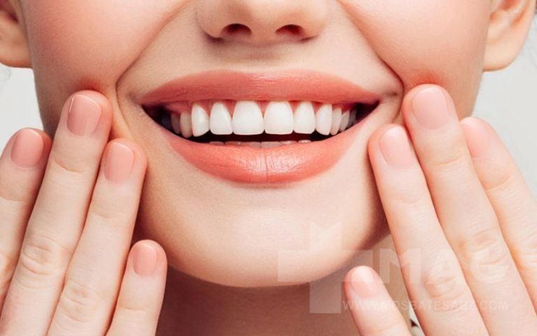 تفاوت لمینت و کامپوزیت