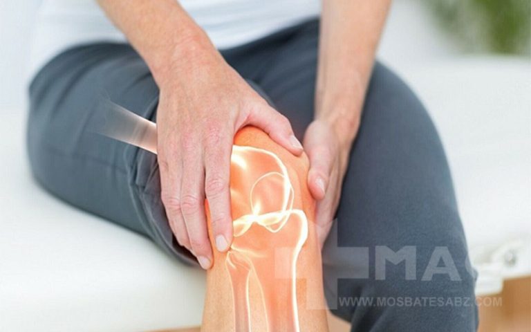 کلاژن برای مفاصل
