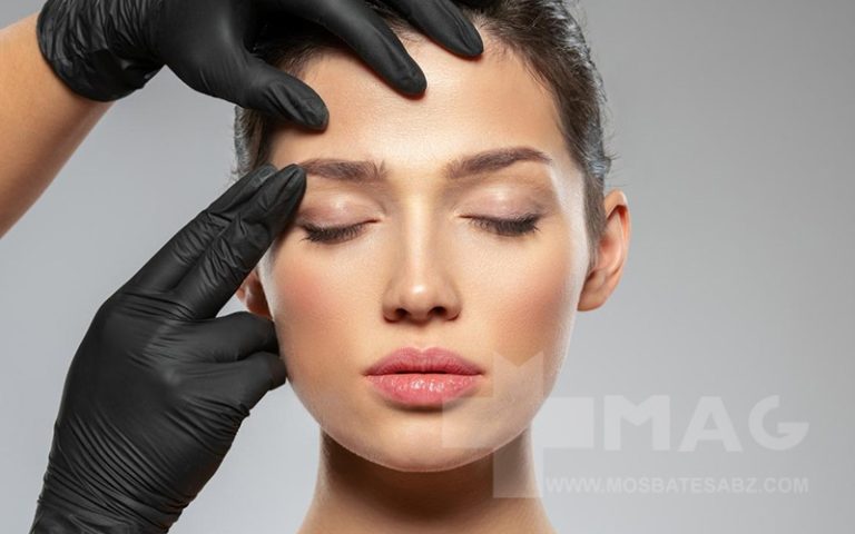 لیفت شقیقه