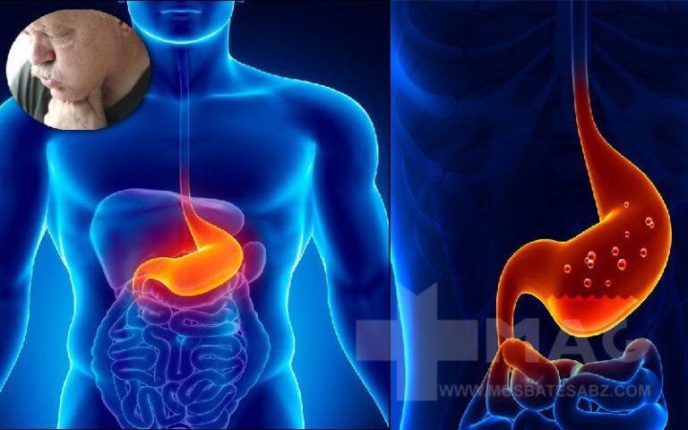 بهترین دارو برای رفلاکس معده