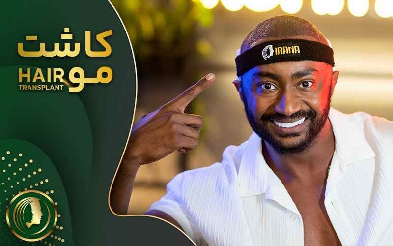 کاشت مو نوین ایرانا