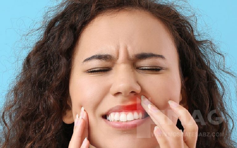 کمبود کدام ویتامین باعث تورم لثه‌ها میشود؟