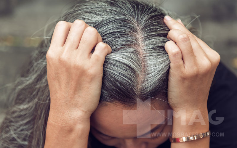 برای جلوگیری از سفید شدن مو چه بخوریم