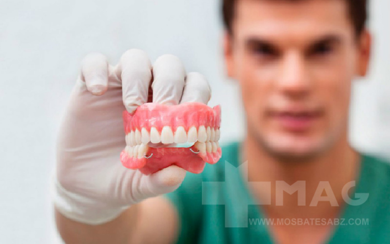 بهترین جایگزین دندان کشیده شده چی بذاریم؟