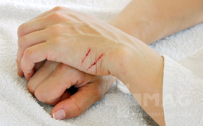 کمبود کدام ویتامین باعث ایجاد زخم‌ های پوستی می شود؟