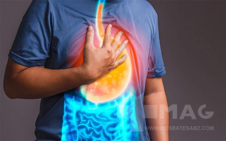 کاهش فوری اسید معده با قرص